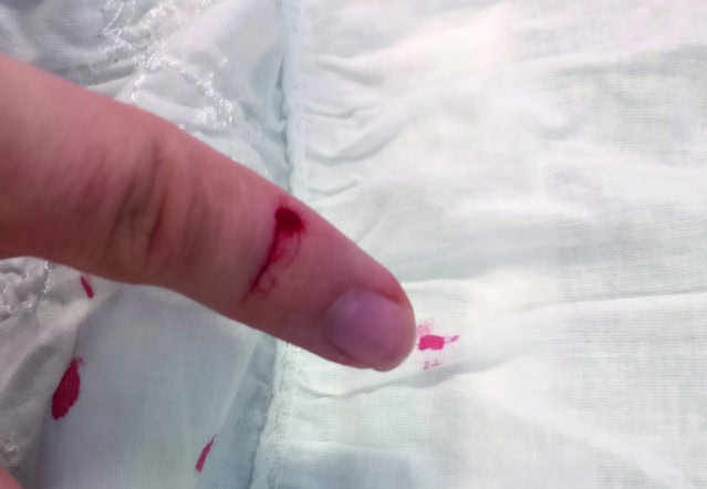 3D-printer Blurolls rand montage scherp