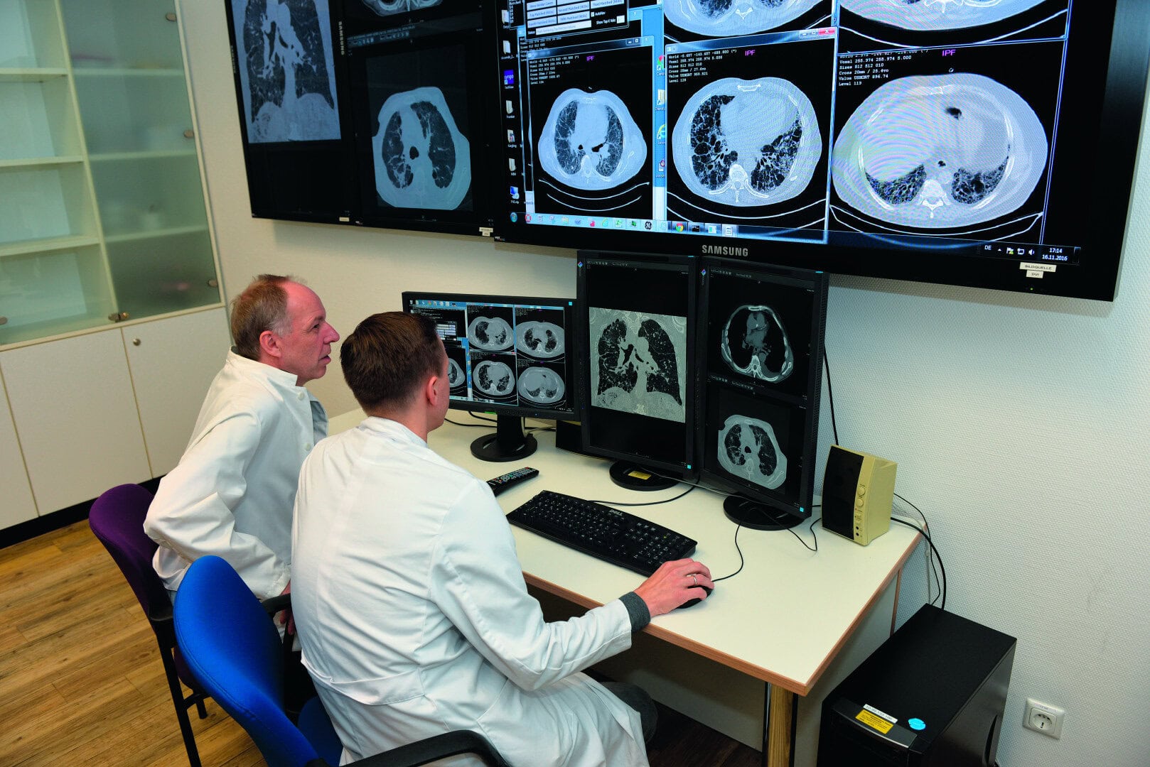 second opinion AI digitale arts diagnose longen longscan radiologie