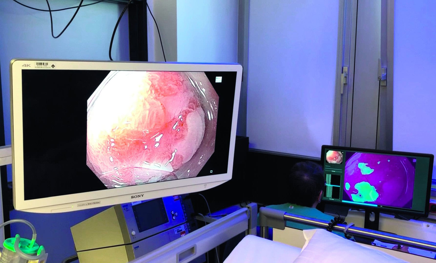 second opinion AI digitale arts diagnose witlichtopname endoscopie