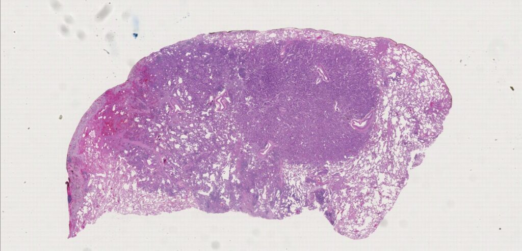 medisch AI-systeem voor analyse scan-slices van een long